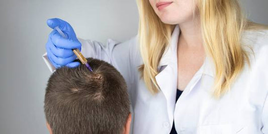 Alopecia Cicatriziale: Quando i Capelli Non Ricrescono Più